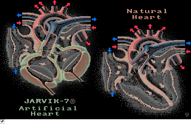 Artificial Heart  DeluxePaint Demo Image, an Amiga Animation by Electronic Arts