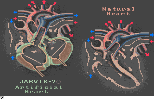 Artificial Heart, an Amiga Animation by Commodore